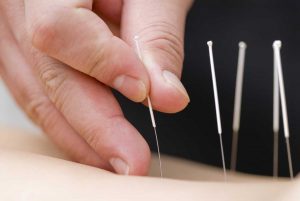 How Acupuncture Works
